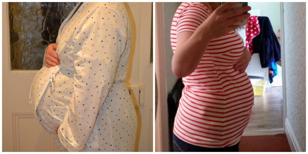 one week post partum